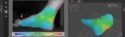 3 D DIC area skin tissue