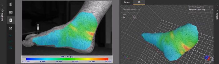 3 D DIC area skin tissue